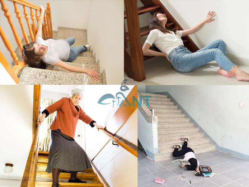 Hậu quả nghiêm trọng khi té ngã cầu thang